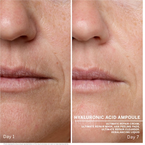 Ампулы с Гиалуроновой Кислотой DOCTOR BABOR