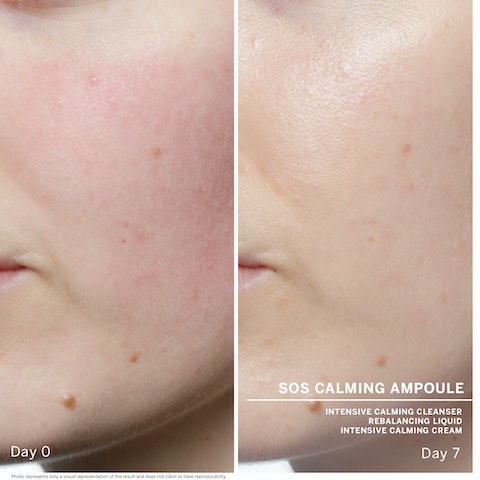 Ампулы SOS Антистресс